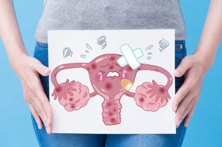 What Is the Difference Between Endometritis and Endometriosis? 