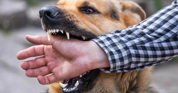 What to Do if You (Or a Loved One) Is Bitten by a Dog