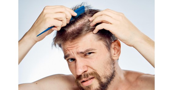 Hair Loss Treatment for Men: Surgical and Non-Surgical Options